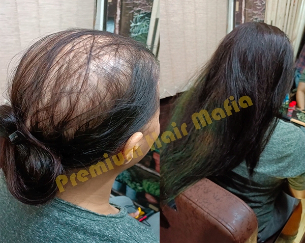 Wigs for Cancer Patients in Gurgaon | 8800411146 | Ladies Hair Wigs Shop