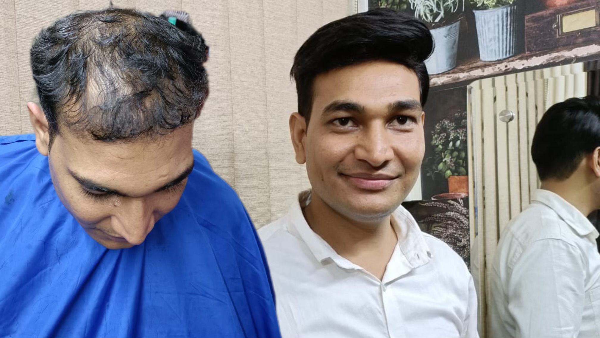 Hair Patch Service in Gurgaon | Hair Patch Near me 8800411146