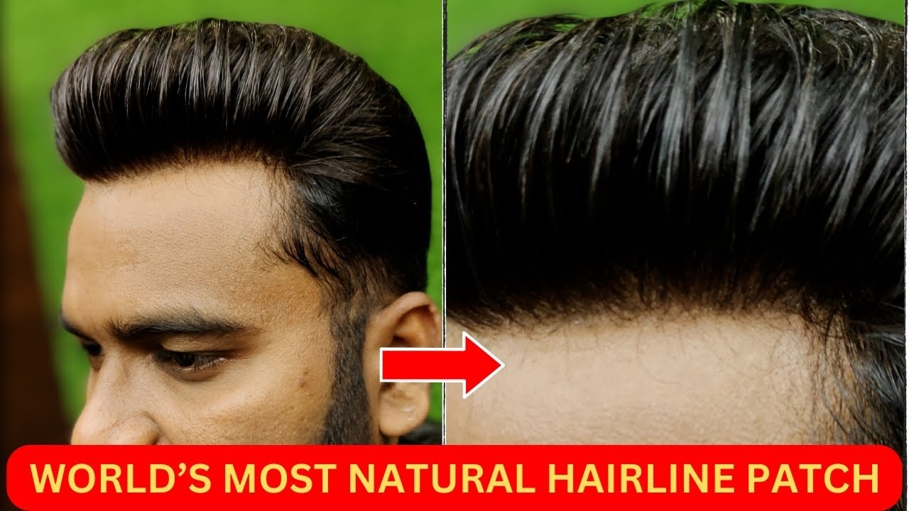Hair Patch in Gurgaon | Hair Patch Service in Gurgaon