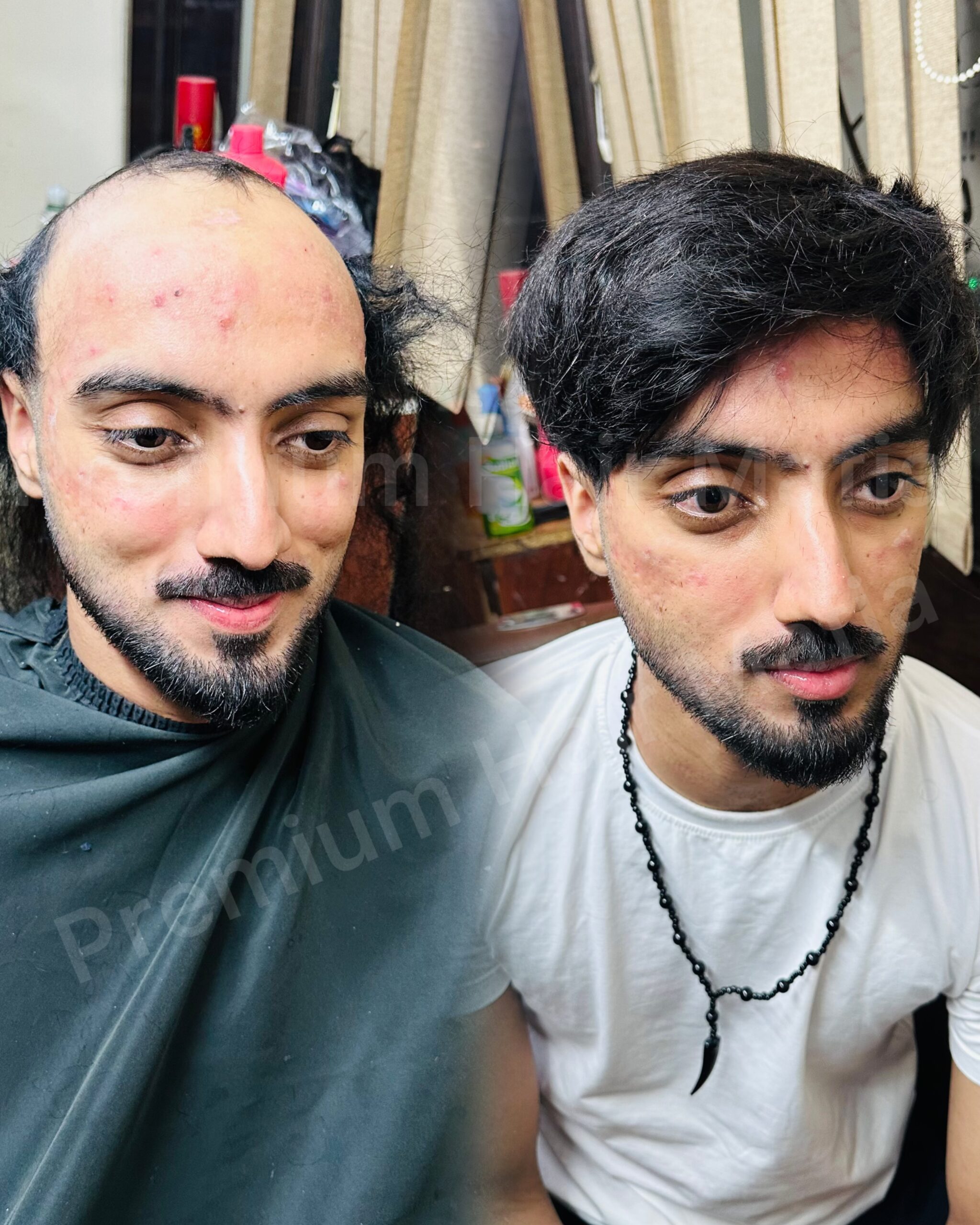 chinese hair patch
