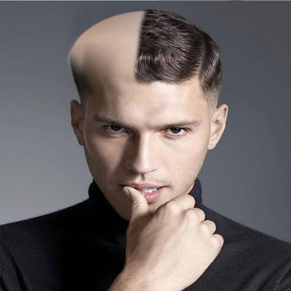 Hair Patch in Gurgaon | Hair Patch Service in Gurgaon | Men Hair Patch