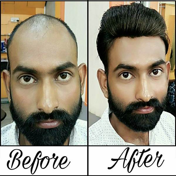 hair fixing before and after
